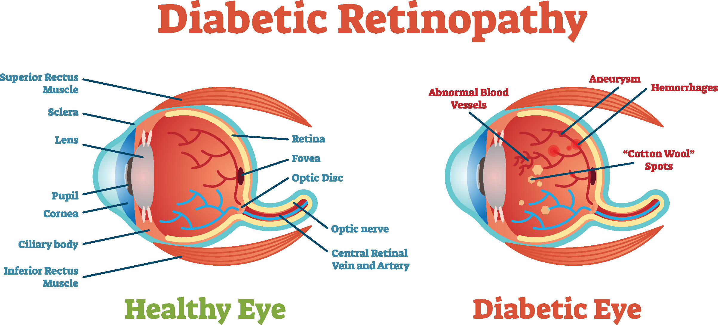 diabetes description