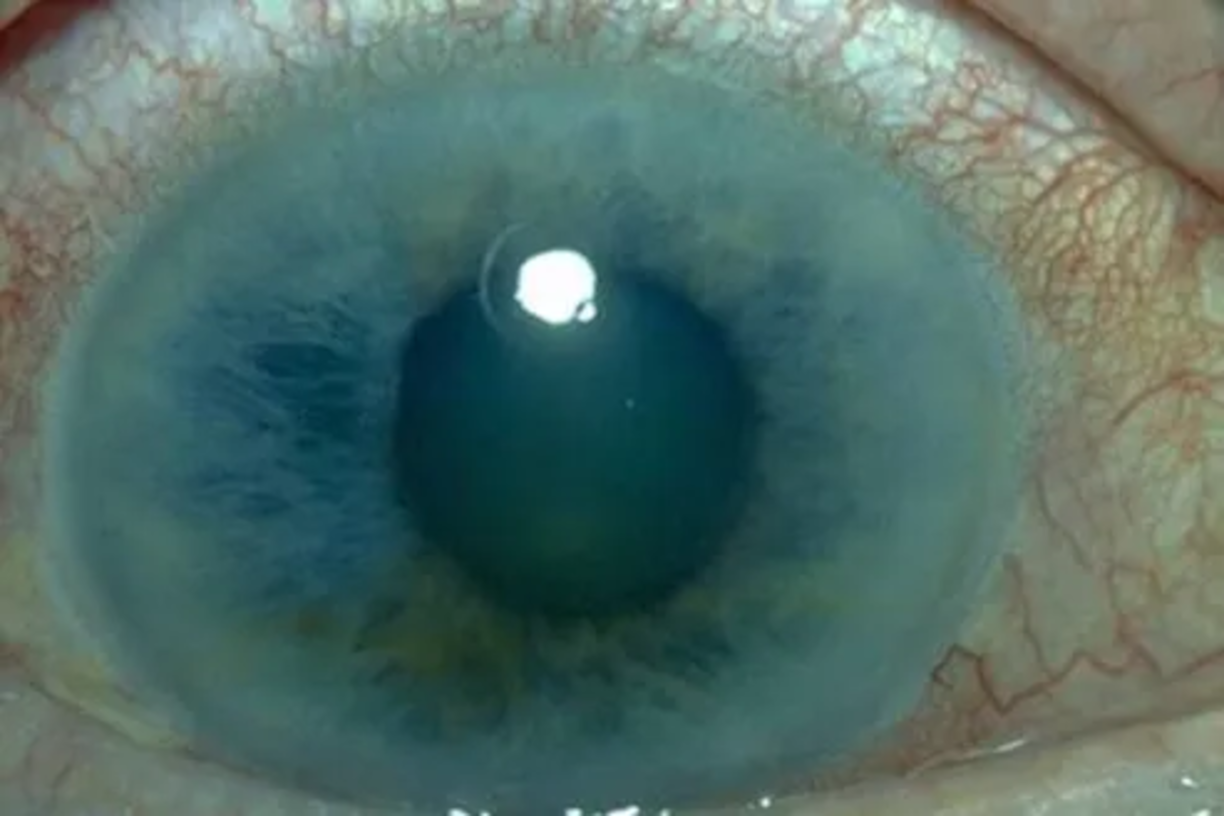 Eye exam frequency recommendations